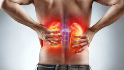 Nguyên nhân đau lưng ở nam giới: Bệnh lý về thận