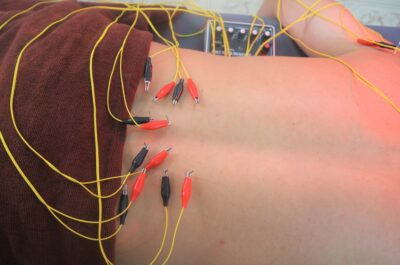 Trị liệu đau vùng thắt lưng ở phụ nữ bằng Đông Y