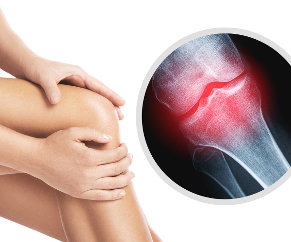 Nguyên nhân thoái hóa khớp gối
