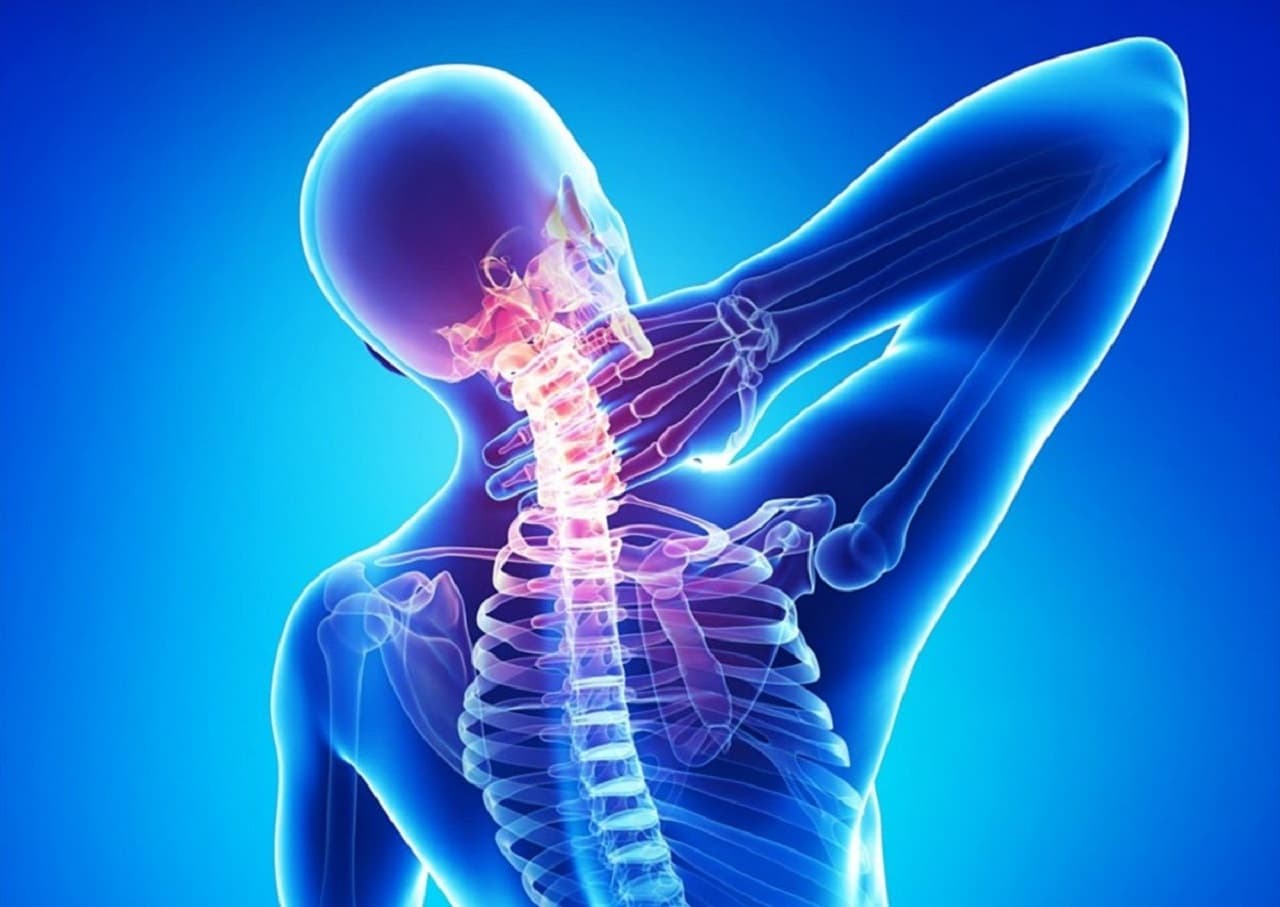 Chẩn đoán bệnh thoái hóa đốt sống cổ