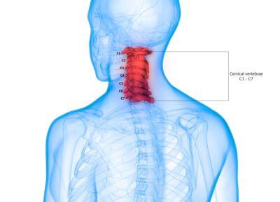 Triệu chứng viêm vai gáy