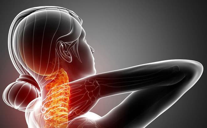 Nguyên nhân dẫn đến đau dây thần kinh vai gáy