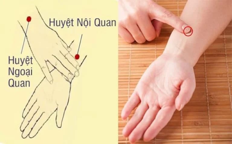 Huyệt Nội Quan