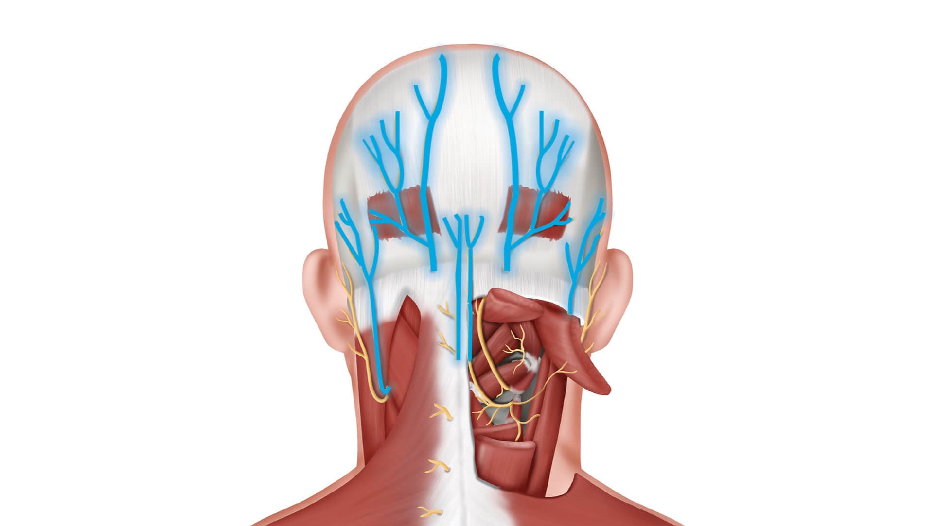 Triệu chứng đau dây thần kinh chẩm
