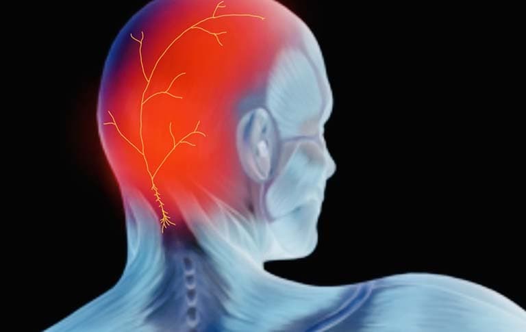 Địa chỉ điều trị đau thần kinh chẩm hiệu quả nhất