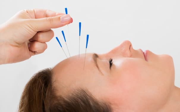 Điều trị bằng phương pháp Đông y