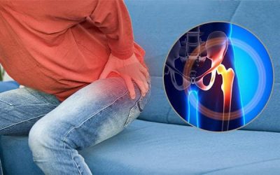 Chẩn đoán trật khớp háng