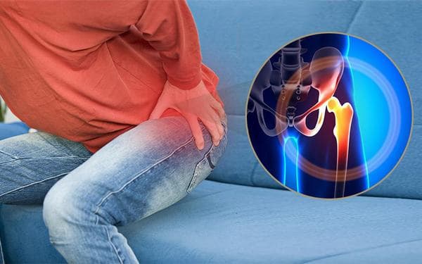 Chẩn đoán trật khớp háng