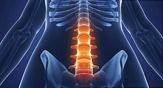 Chẩn đoán viêm cột sống dính khớp 