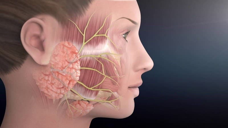 Cải thiện lệch mặt