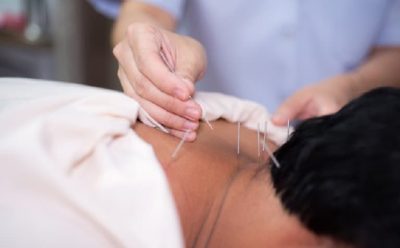 Châm cứu thoát vị đĩa đệm là gì?