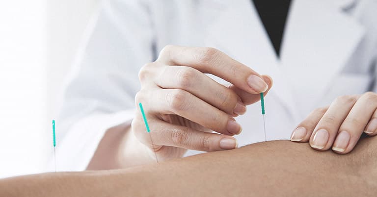 Châm cứu điều trị Thoái hoá đĩa đệm L5 S1