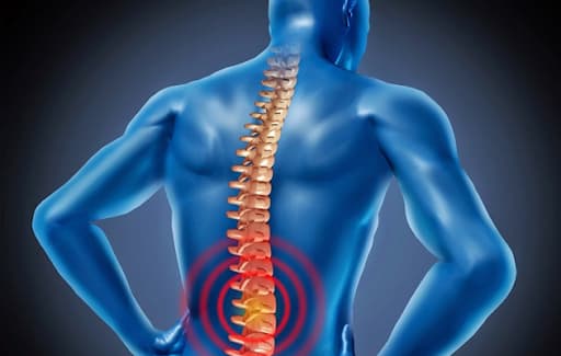  Triệu chứng của thoát vị đĩa đệm lưng