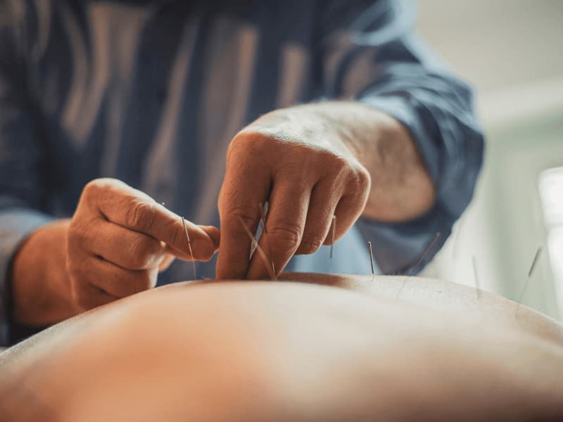Châm cứu chữa thoát vị đĩa đệm thắt lưng