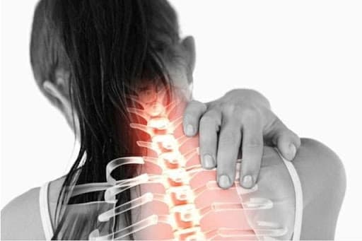 Các triệu chứng thường gặp của cứng cổ