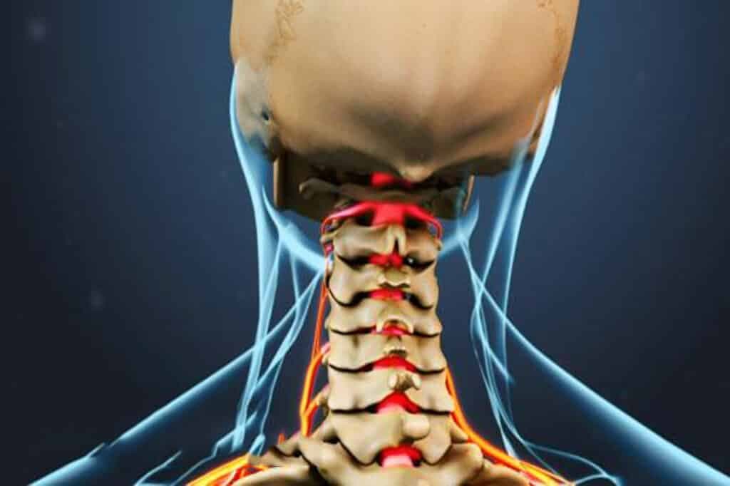 Nguyên nhân gây đau vai gáy cứng cổ