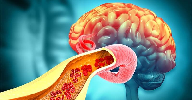 Nguyên nhân gây đau mỏi vai gáy chóng mặt
