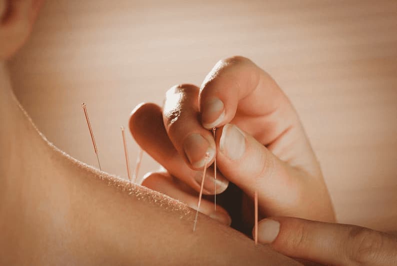 Phương pháp điều trị đau mỏi vai gáy chóng mặt