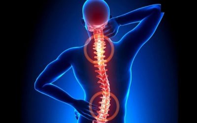 Triệu chứng của lồi đĩa đệm