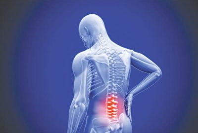 Triệu chứng của thoát vị đĩa đệm thể trung tâm
