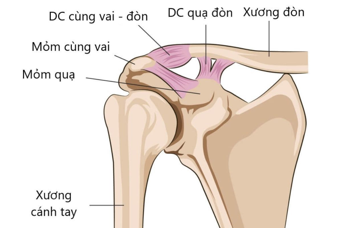 Nguyên nhân và triệu chứng nhận biết xương đòn vai nhô cao