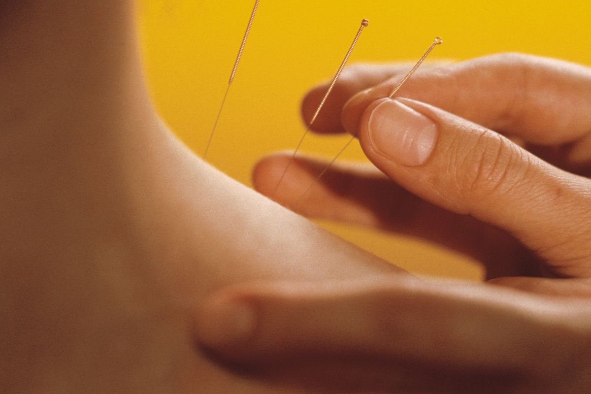 Phương pháp điều trị trật khớp vai tái diễn trong Đông y