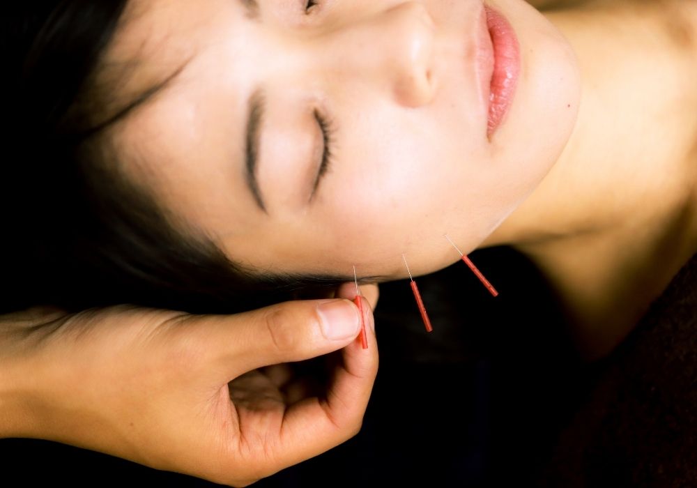 nắn chỉnh mặt lệch