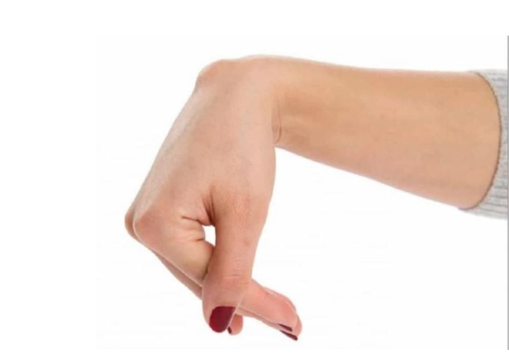 Bài tập chữa tê tay: Duỗi gập cổ tay