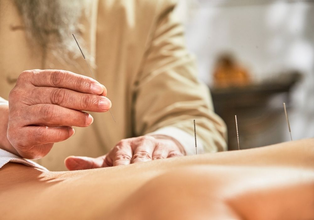Châm Cứu Điều Trị Đau Cổ Vai Gáy Cấp Tính