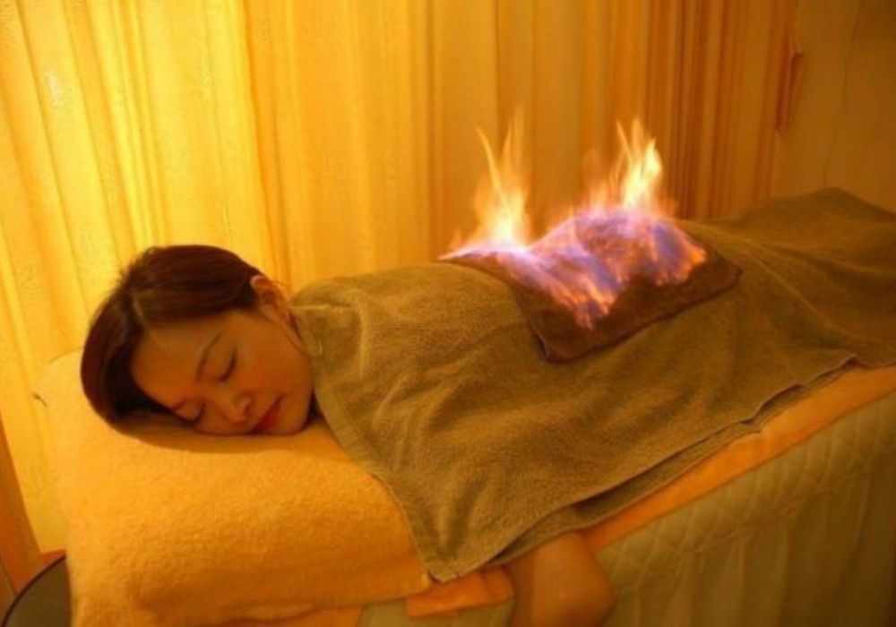 Hỏa trị liệu trong điều trị đau vai gáy