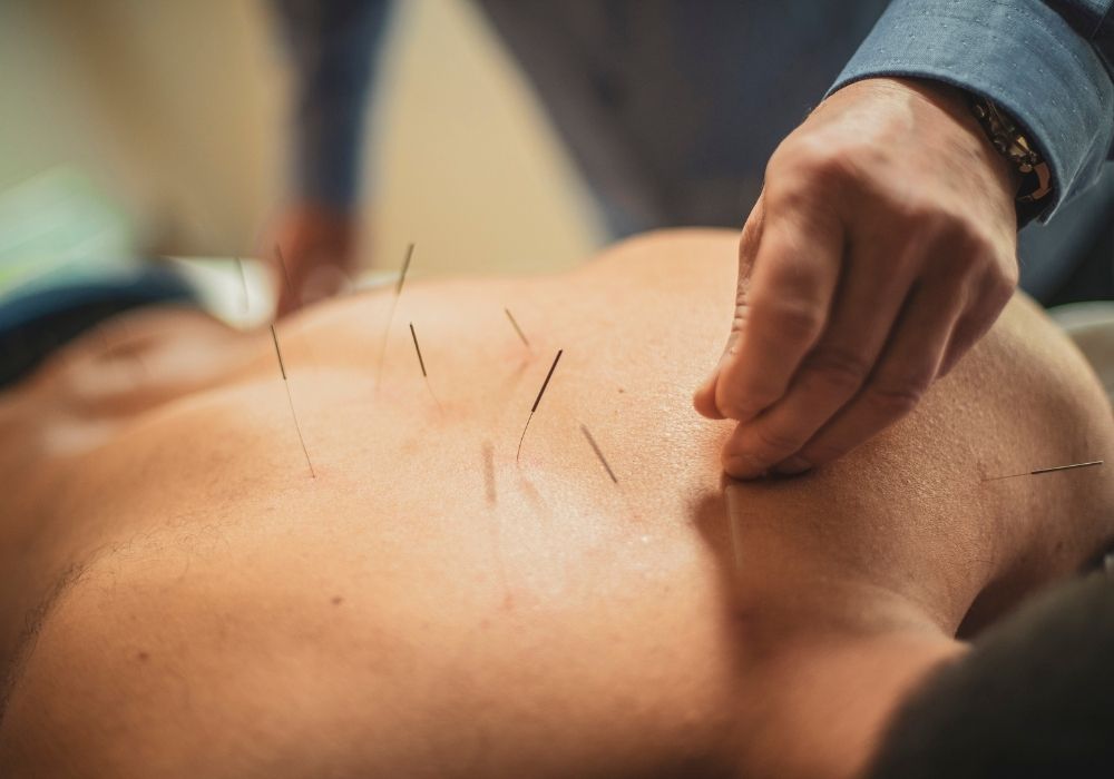 So sánh hoả trị liệu với các phương pháp khác: châm cứu, vật lý trị liệu....