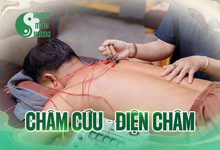 cham-cuu-dien-cham
