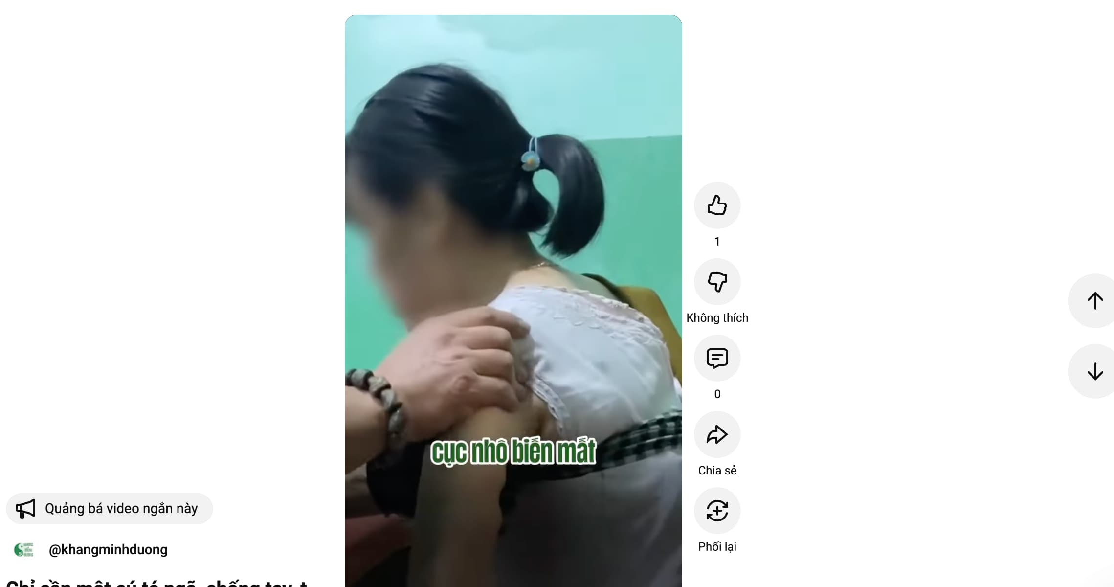 Chỉ cần một cú té ngã, chống tay, tập thể thao sai cách sẽ gây trật khớp vai 