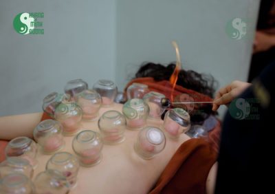 Chữa thoái hóa cột sống không phẫu thuật