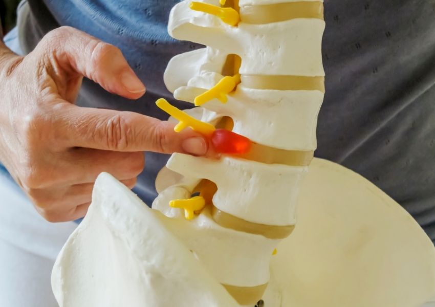 Đông y và Tây y trong điều trị thoái hóa cột sống không phẫu thuật