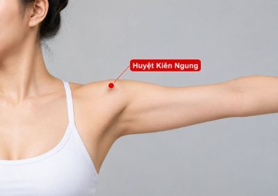 Huyệt Kiên Ngung là gì?